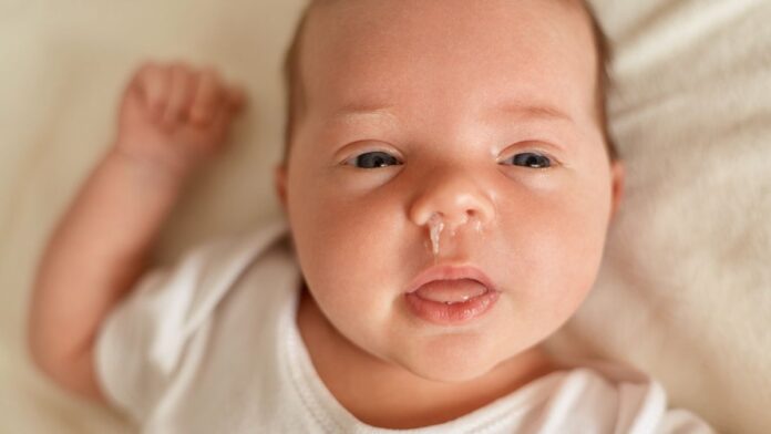 5 Cara Tradisional Mengatasi Hidung Tersumbat pada Bayi